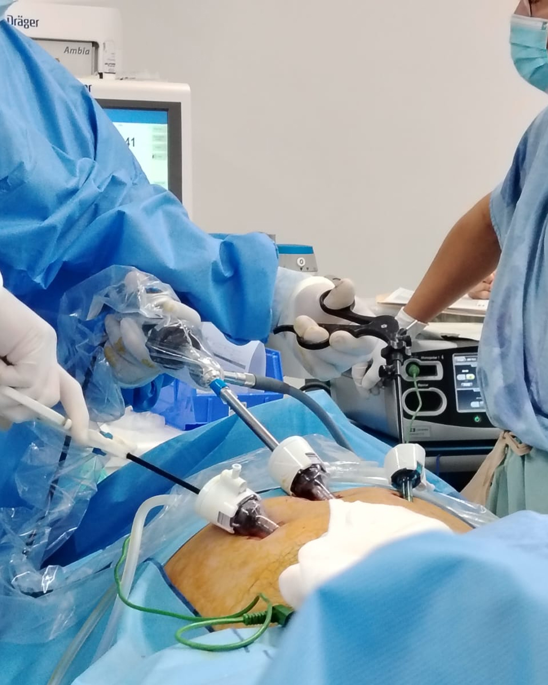 Apendicitis